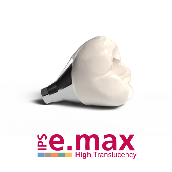 IPS e.max CAD High Translucency Implant Crown – Hatzakortzian Dental ...